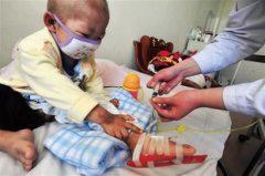 “白血病”兒童增加，甲醛危害值得關(guān)注